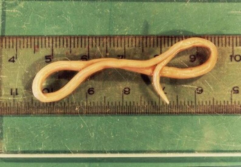 parasito de vermes redondos do corpo humano