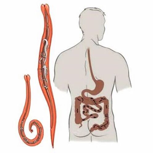 vermes nos intestinos humanos