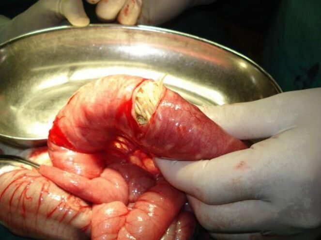 os parasitos de ches son perigosos para os humanos